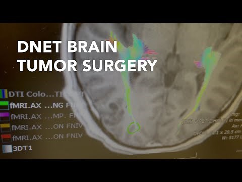 Resection of Dysembryoplastic Neuroepithelial Tumor (DNET)