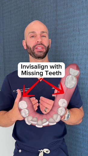 Dental Implants and Invisalign for Ages 25-75: Aligning Your Smile