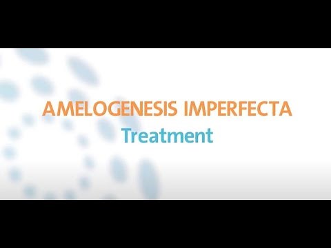 Amelogenesis imperfecta: Treatment & management