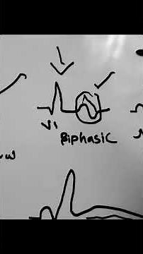 "T Wave Variations on ECG 💓 | Normal vs Abnormal T Waves" #ecgs #ecg #emedicine #ecginterpretation