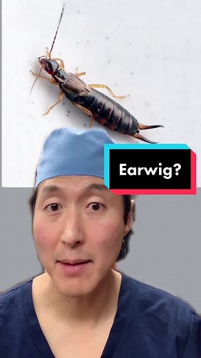 Earwig In Ear: Symptoms, Bites, and Removal