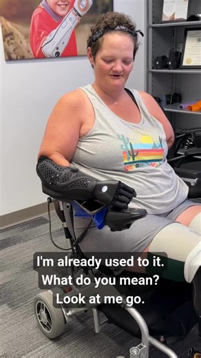 A bit of user feedback and the ULTIMATE upgrade! Grateful to all of our users who give us feedback which helps make the best prosthetics! Kristin you are an amazing lady! 🦾❤️ #HeroPRO #evolution #upgrades #bionicarm #technology #community #wholesome | Open Bionics