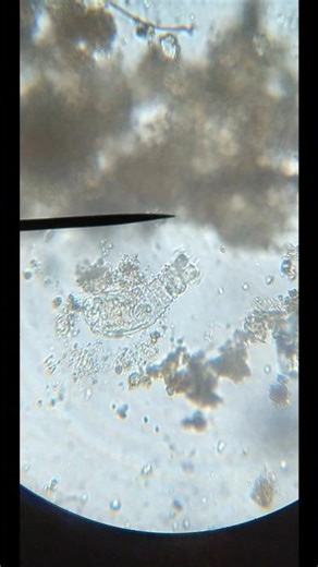 Virpotājs / The rotifer / Rotifera 😎🔬 #nature #microscope