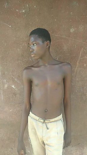 skinny flex on TikTok