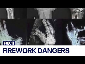 The dangers of fireworks