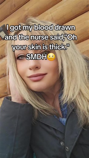 Understanding Scleroderma: Personal Insights