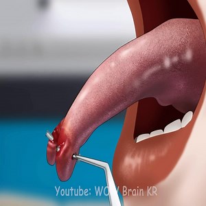 171K views · 955 reactions | Piercing no labial #gameplay #relaxing | Dvitor | Facebook