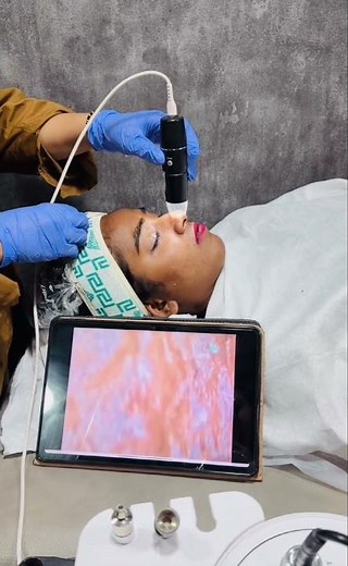 Skin Analyzer Test 😱 | Know Your Real Skin Condition