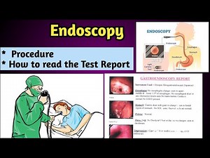 Endoscopy Detailed Video | Procedure and How to Read Endoscopy Report