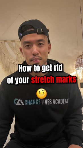 Effective Ways to Remove Stretch Marks After Losing Weight