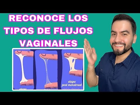 Types of Vaginal Discharge | Dr. David Campos