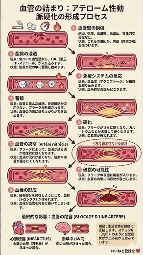 【放置厳禁】自覚症状ゼロから心筋梗塞へ。血管内に「プラーク」ができる本当の理由と対策