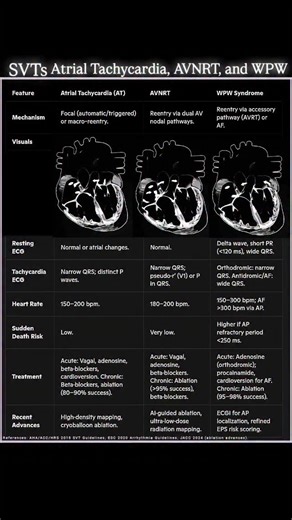 Abdallah Othman on Instagram: "SVTs Atrial Tachycardia, AVNRT (Atrioventricular Nodal Reentrant Tachycardia), and WPW (Wolff-Parkinson-White Syndrome) #Electrophysiology #SVT #Cardiology #ECG #wpw #avnrt #Tachycardia #Arrhythmia #Ablation #EPeeps #MedEd #FOAMed"