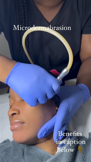 10 Benefits of Microdermabrasion Here are the ten best reasons why microdermabrasion could be the right choice for you: 1. Improves the skin’s texture Microdermabrasion can be used to treat coarse skin. The microcrystals in the treatment help remove the outer layer of dead skin cells, revealing smooth new tissue underneath. 2. Reduces scars Microdermabrasion can smooth the edges and surface of a scar, as well as stimulate collagen production to produce healthy new skin cells—all of which help he