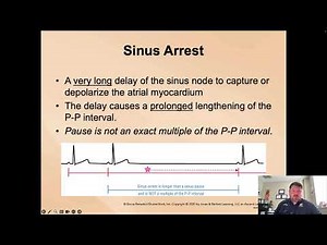 Paramedic Cardiology Module 3-1 Lecture 5: Sinus Pause Block and Arrest