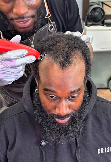 His Receding Hairline made him want to give up & go BALD😭🥚, so we Blessed him w/ a High Bald Taper🔥 Laurel, MD📍 Now accepting New clientele 💯 Book Haircut 💈w/ Link in Bio #ezcutz #haircuttransformation #newhaircut #hightaper #hairlinerestoration