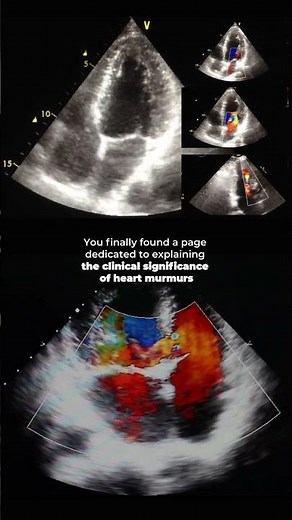Don’t Overlook Heart Murmurs and Their Clinical Significance!