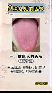 9种常见舌象 健康舌象与常见问题