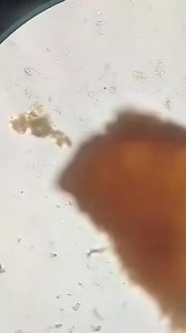 Stool sample 😍 #laboratorymedicine #MedicalLabTechnician #lablife #microbiology | Lab life