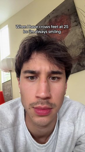 Crows Feet Treatment and Smile Lines at a Young Age