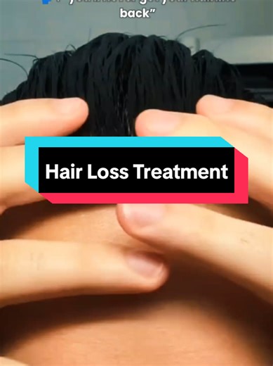 Rovaleon (@rovaleon.selfcare) - Tap the link in bio to get the full step-by-step guide to reverse hair loss. Important🚨: -This is a paid guide (65% OFF for less than 24 hours). -This guide is for those truly committed to transforming their hair. Those who are ready to take action and see real results! #hair #hairgrowth #hairgrowthtips #haircareroutine #hairlosssolutions #alopecia #gym #confidence #beforeandafter #fyp #goviral