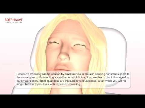 Fillers and botox Animations - Boerhaave Medical Centre