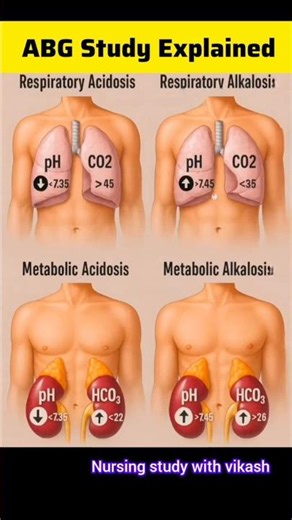 ABG Explained / ABG Kaise dekhe #shorts #viral #misspanghal