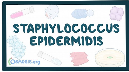 Staphylococcus epidermidis: Video, Causes, & Meaning | Osmosis