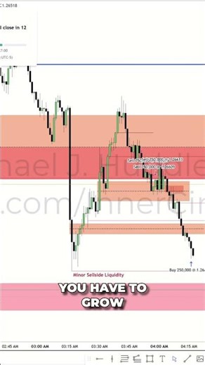 Trading Losses: Trust Your Moves, Master Stop Loss! #shorts