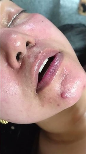 #using expired cosmetics cause allergies all over skin , check expiry date before use any cosmetics