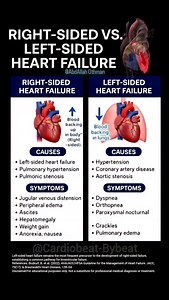 1.9K views · 569 reactions | Right vs. Left-Sided Heart Failure: Right-Sided HF: Impaired RV output → Systemic venous congestion. Left-Sided HF: Impaired LV output → Pulmonary venous congestion. #HeartFailure #Cardiology #MedEd #MedicalEducation | Abdallah Othman | Facebook