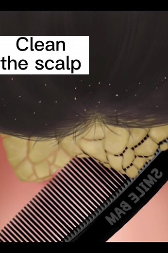 The girl’s long hair must be cleaned,or the insects will grow #fyp #tiktok #foryou #animation #asmr #cartoon #stopmotionanimation #clean