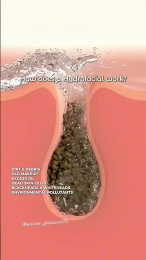 How Does a Hydrafacial Work? | Real Results, Step-by-Step Process & Benefits Explained!