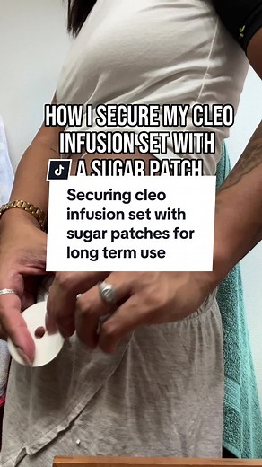 The adhesive for the Cleo infusion sites barely holds for a couple days. When subcutaneous remodulin patients use these sites for weeks at a time, this is how i secure mine. This set up lasted 6 weeks, but i did need to secure the sides when they started to lift. #Subqremo #sickfightsback #invisibleillnessawareness #spoonielife #noteverydiseaseisvisable #chronicillnessawareness #heartfailure #pulmonaryhypertension #chronicillnesswarrior #pulmoaryarterialhypertension #rarediseaseawareness #phight
