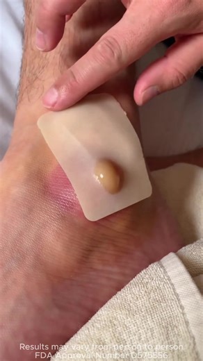 😭Can’t stand the joint pain anymore? Use the right method, and you can relieve the pain in just three days！knee pain Savior！#Painreliefpatch #musclepain#DrMitsui#heatapplicationtorelievepain#DRMITSUIpainreliefpatch-PH