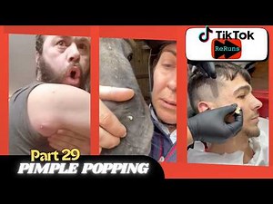 Pimple Pop 29 | Uninterrupted | TIKTOK RERUNS