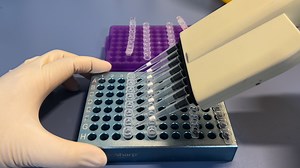 Identification of <em>Mycobacterium</em> Species by DNA Microarray Chip Method