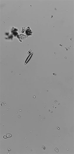Beautiful Navicula diatome on a journey through microspace #science #microscope 14