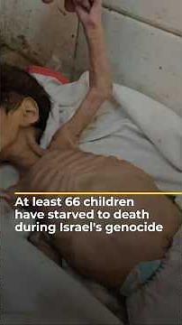 At least 66 children in Gaza have starved to death during Israel's genocide | AJ #shorts