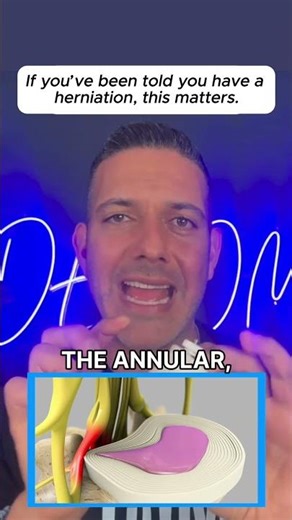 Stop treating herniated discs as just a 'disc problem'—Discover real relief! #HerniatedDisc