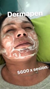 2.4K views · 35 reactions | Dermapen !! Cierra poros ! Elimina manchas ! Penetra Hialuronico micro agujas ! Muy bueno para el cuidado de la piel ! Valor real 1200 2 x1 ! | Dra. Anahi Versace | Facebook