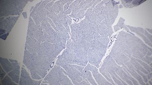 Cardiac Muscle in Section Filmed on Bright Field Background Under Microscope 40x Stock Video - Video of human, coronary: 256384987