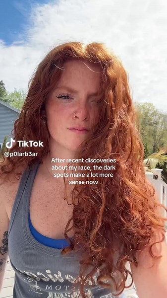 Gingers Are Black: Exploring Cultural Identity