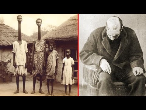 15 Circus Freaks You Won't Believe Truly Existed!