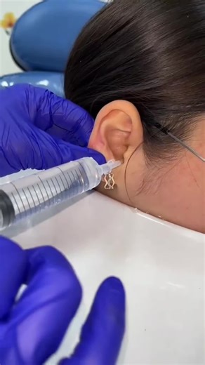 Terrifying Discovery in a Deaf Woman's Ear