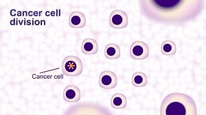 7.3K views · 89 reactions | Lymphoma is the fifth most common type of cancer in the UK, but many people still know little about it. If you have recently been diagnosed and would like more information for yourself, or to share with friends and family, this video might help. Please share to help us spread awareness  | Lymphoma Action | Facebook