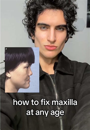 Maxilla = Beauty. #looks #transformation #glowup #face #selfimprovement