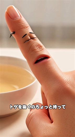 ピンセットで棘を抜くの待って！#ライフハック