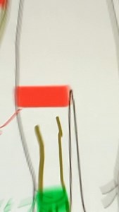 Convex concave rule 🤩✅ #anatomy #physiotherapy #physicaltherapy #physical_therapy #medstudent | Dr. Mina Melika