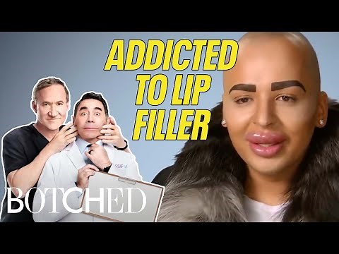 5 BOTCHED Lips: Illegal Injections, Filler Addictions, and Freak Accidents | Botched | E!